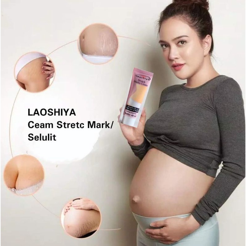 LAOSHIYA Stretchmark Cream / Penghilang Stretch Mark / Selulit Ampuh Original