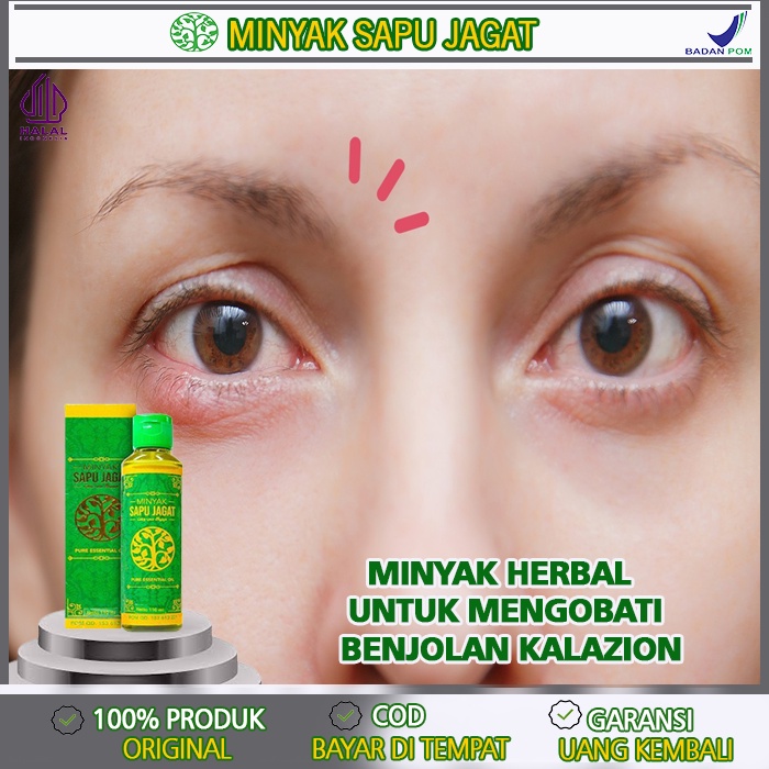 Jual Obat Kalazion Obat Penghilang Benjolan Kalazion Obat Kalazion