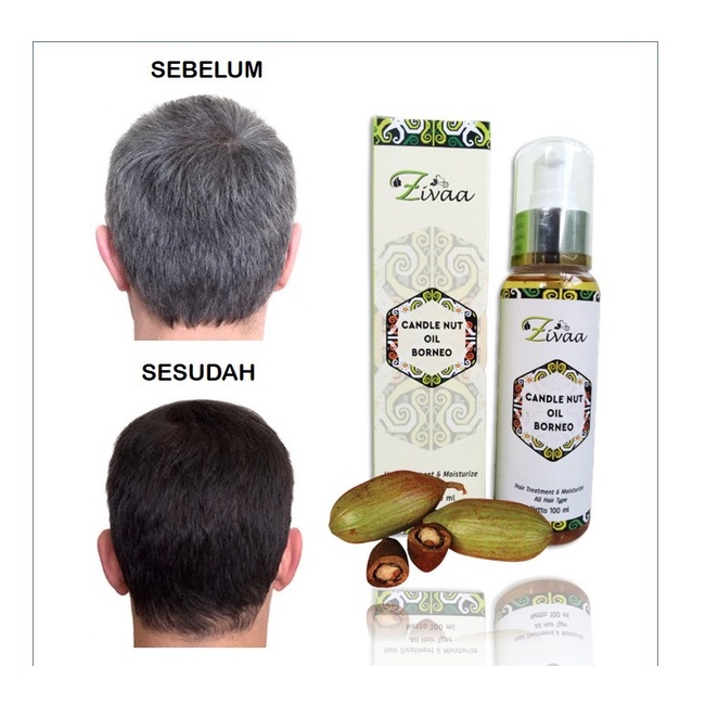 ZIVAA [BISA COD ] CANDLE NUT OIL BORNEO PENGHILANG UBAN/ANTI UBAN/PENGHITAM RAMBUT UBAN PERMANEN
