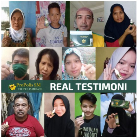 Obat Jari Tangan Kering, Obat Oles Kulit Jari Mengelupas, Obat Telapak Tangan Kasar, Salep Jari Tangan Gatal, Obat Kulit Jari Pecah Pecah, Gatal Berair, Ruam Gatal Gatel, Kuman Air / Kutu Air Dengan ProPolis SM