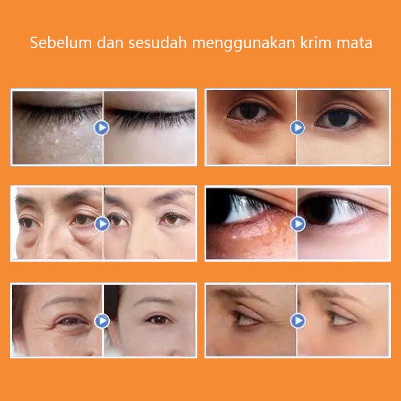 serum mata cream mata panda dan kantung mata Krim mata 20g  memudar lingkaran hitam  Hidrasi dan Pelembab  memperbaiki keriput mata