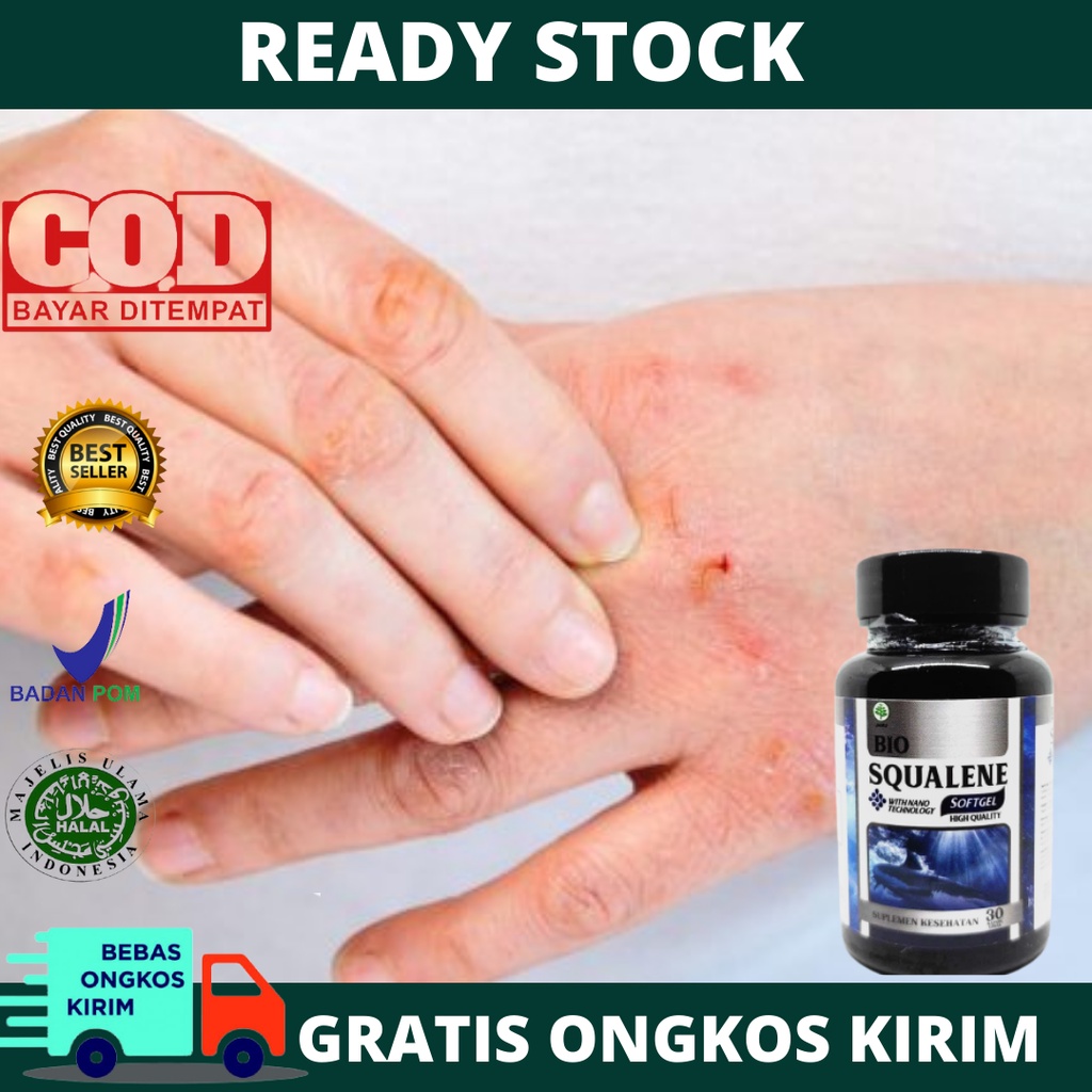 Obat alami scabies pada manusia