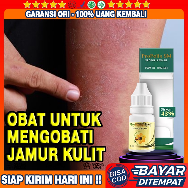 Obat Jamur Kulit, Obat Panu, Obat Gatal, Obat Eksim, Obat Kurap, Obat Kudis, Obat Anti Jamur Kulit, 