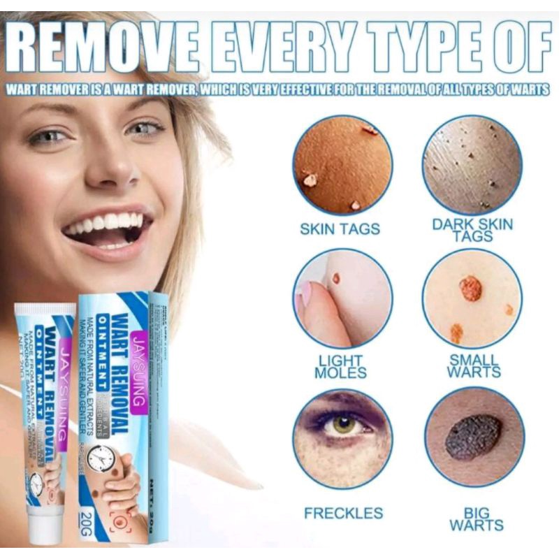 Obat Kutil Tahi Lalat Mata Ikan Skin Tags Moles