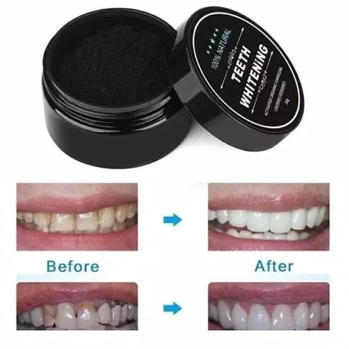 Chorcoal Powder Pemutih Gigi Arang Aktif Ampuh TEETH WHITENING