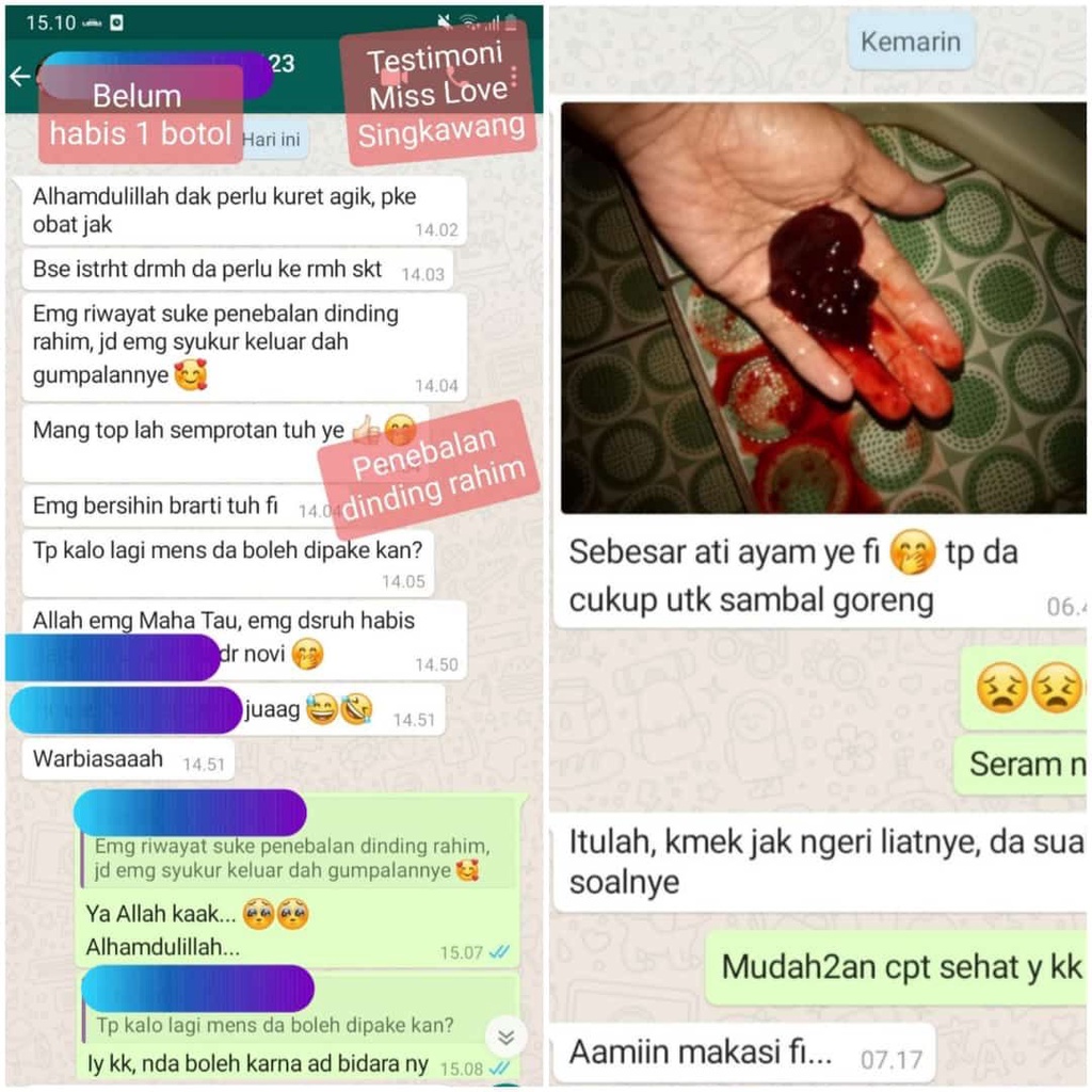 MISS LOVE SPRAY Obat Kista Paling Ampuh - Atasi Kista Ovarium - Herbal Kista Dan Miom - Kista Coklat - Kista Bartholin - Kista Dirahim - Penghancur Kista Miom - Kanker Serviks, Haid Bermasalah - Keputihan, Kemandulan - Herbal Alami Terampuh Original Bpom