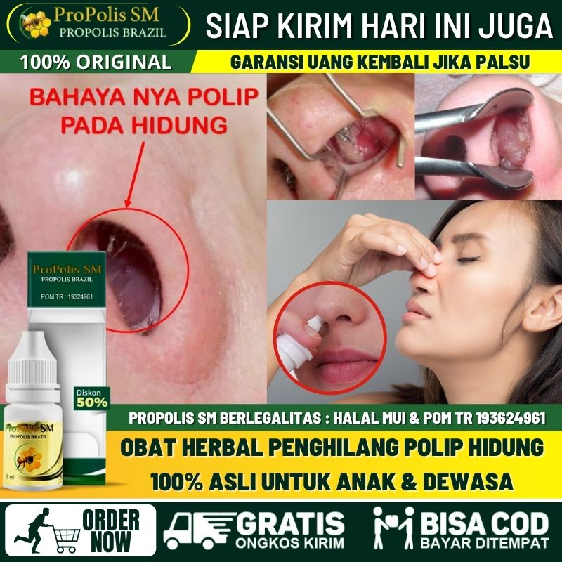 Obat Perontok Polip Hidung Secara Alami Untuk Anak & Dewasa, Obat Hidung Tersumbat Polip, Tumbuh Dag
