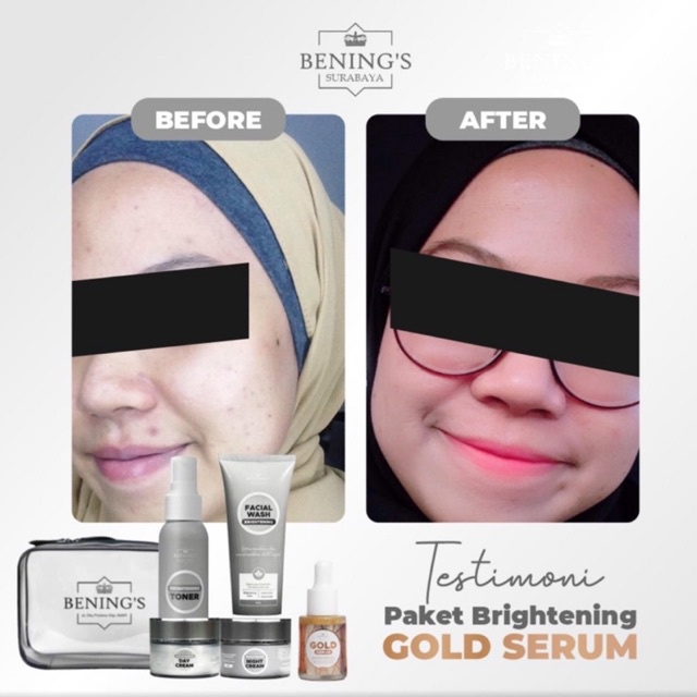 BENING'S PAKET BRIGHTENING | MENCERAHKAN DAN MENGATASI KULIT KUSAM