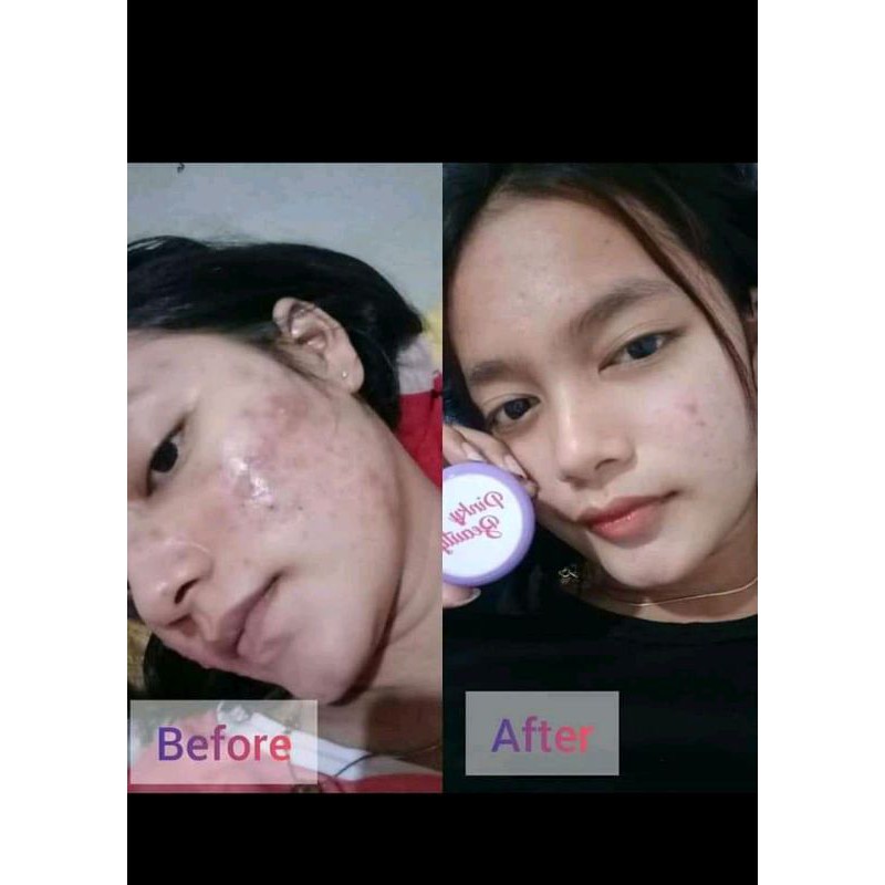 ECER CREAM PINKY BEAUTY IMELDA YUNUS CM CUCO MEONG ORIGINAL