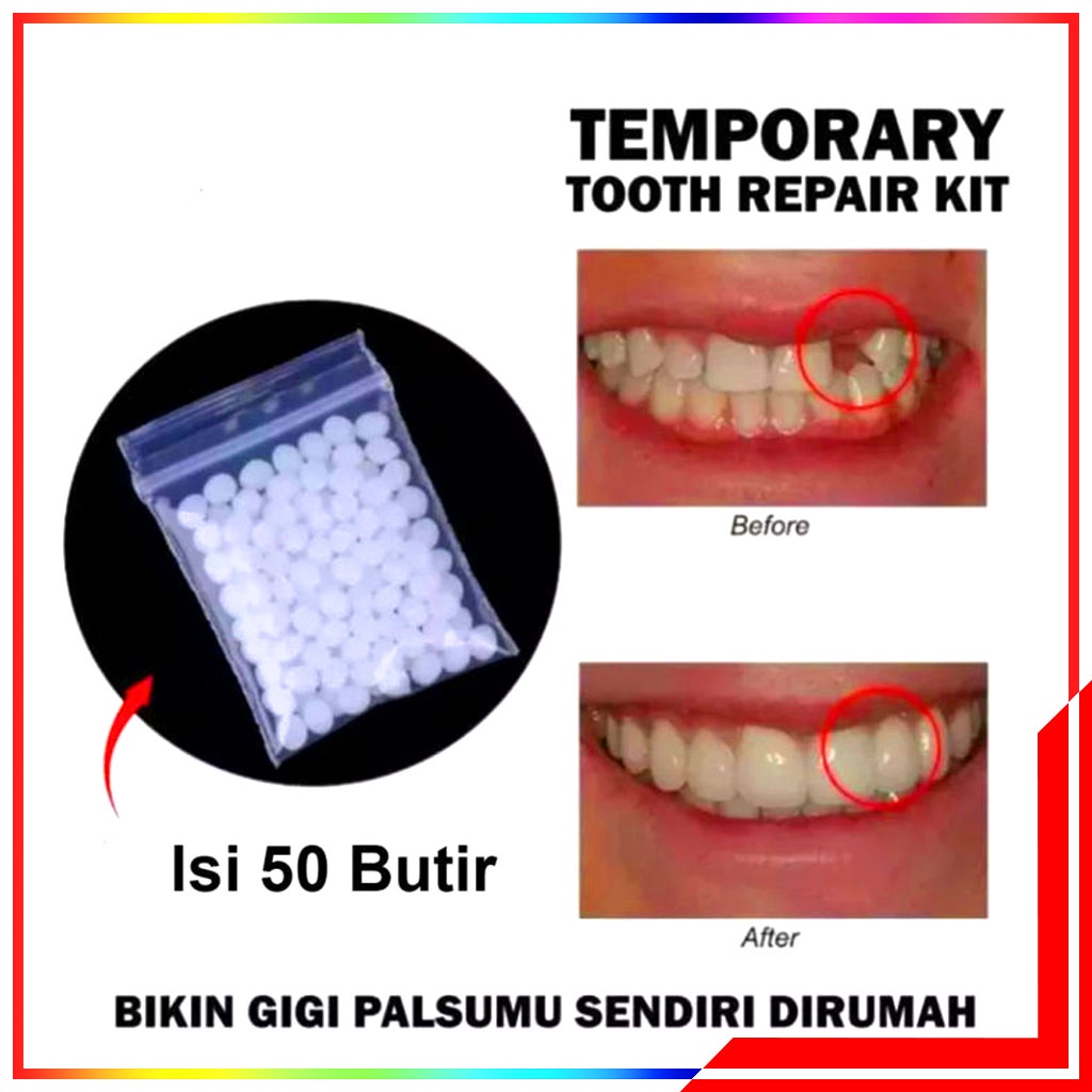 Gigi Palsu / Penambal Gigi Temptooth Toothtemporary Isi 100 Butir