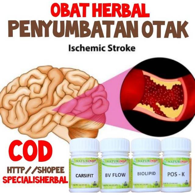 carsifit naturindo obat strok setroke struk stroke struk naturindo carsifit herbal stroke cod cod