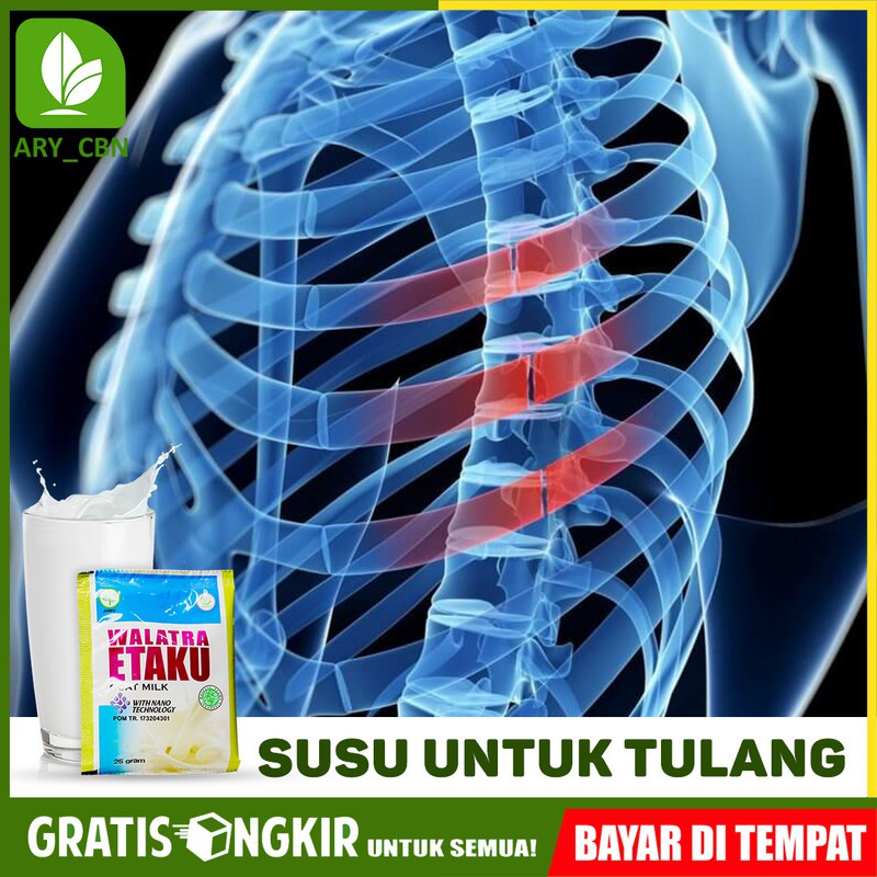 

Susu Untuk Tulang Dan Sendi - Orang Tua - Keropos - Kropos Susu Kambing Murni Etaku di Cirebon