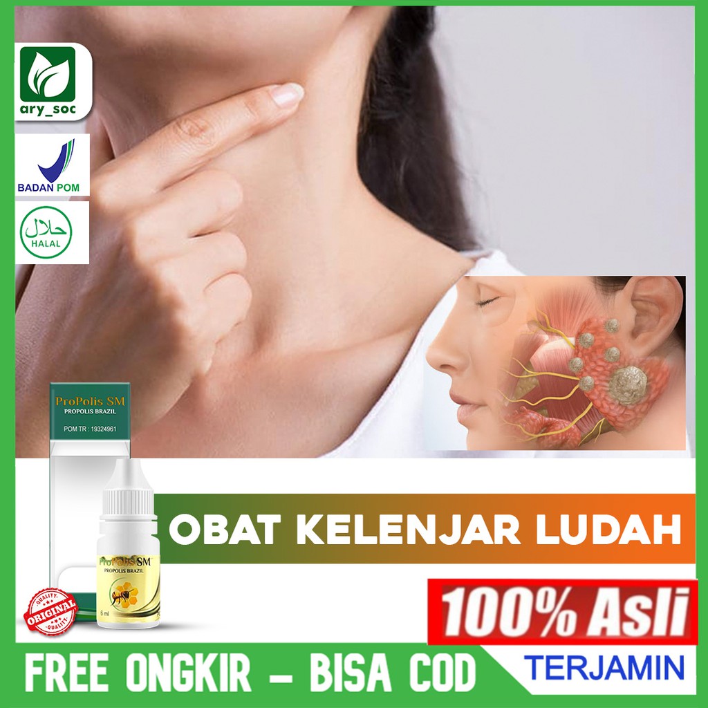 Obat Kelenjar Ludah Kelenjar Air Liur Tersumbat Herbal Alami Banyak Dicari Propolis Sm Original Shopee Indonesia