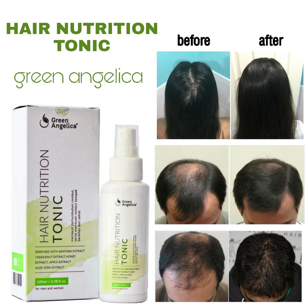 Hair Tonic - Solusi Treatment Penumbuh Rambut Botak dan Rontok yang Ampuh Tanpa Efek Samping - BPOM