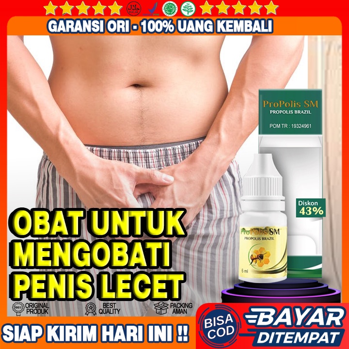 Obat Penis Lecet, Oles Penis Lecet, Penis Gatal, Vagina Gatal, Gatal di Kemaluan Pria Wanita