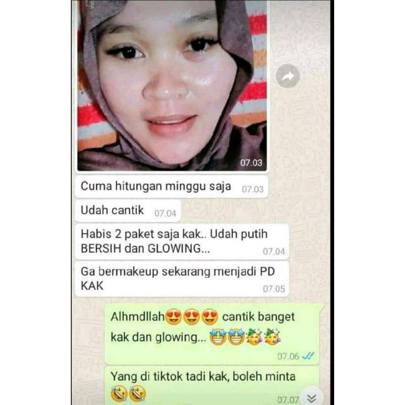 Paket Komplit Flek Hitam Zayora Skincare Penghilang Flek Membandel Ampuh Hilangkan Flek Hitam