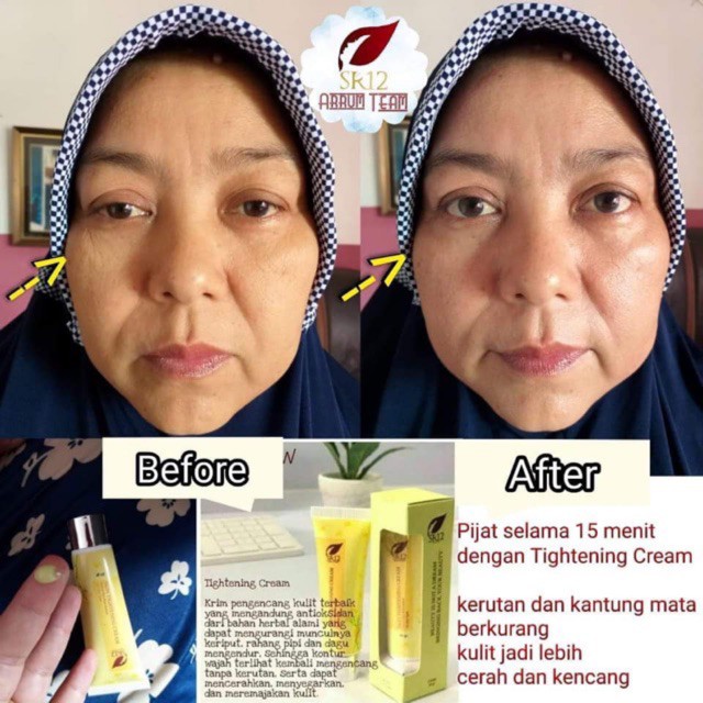 ANTI KERUT WAJAH / PEMUTIH &amp; PENCERAH WAJAH / HERBAL TIGHTENING CREAM / PENGENCANG KULIT WAJAH HALUS