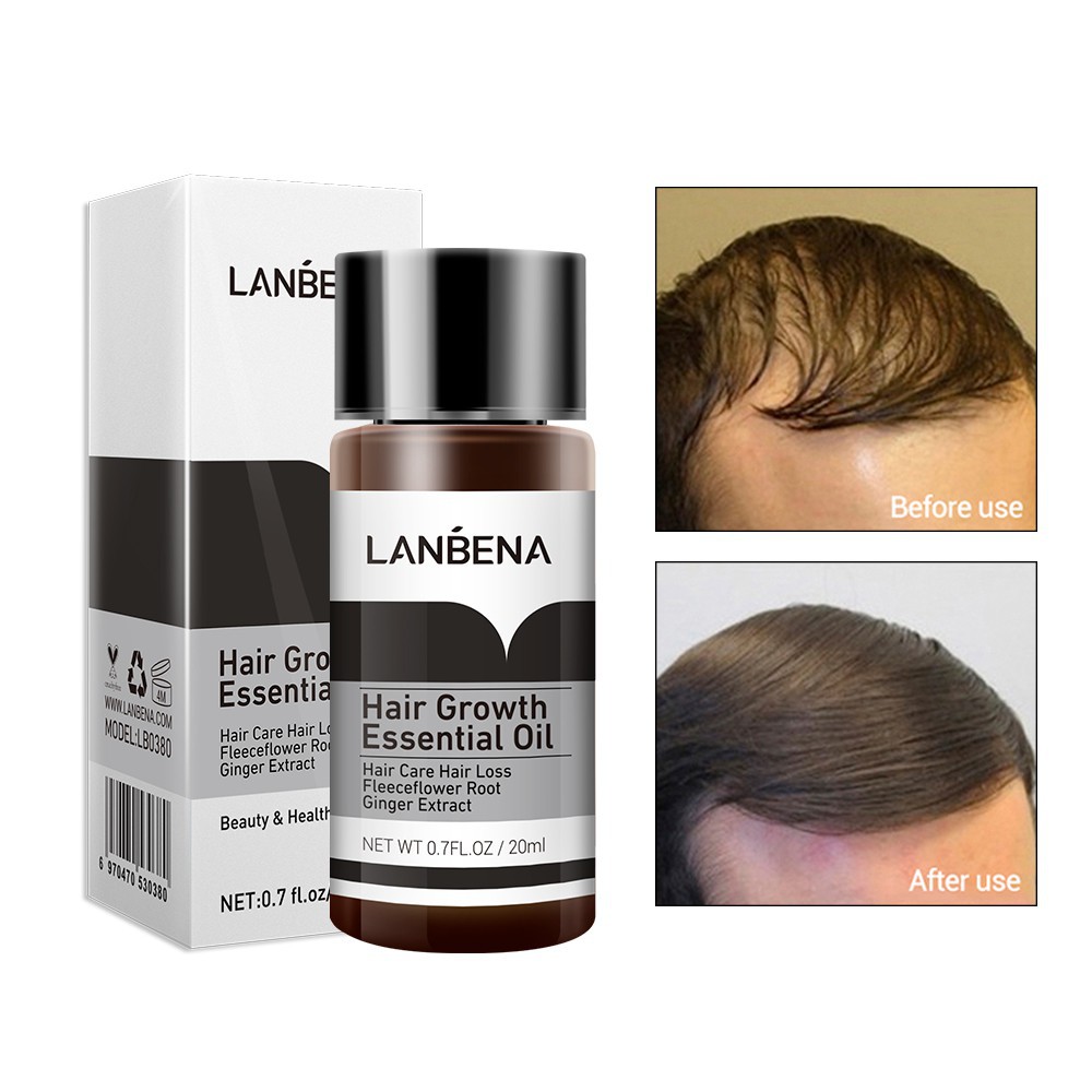 LANBENA HAIR SERUM PENUMBUH RAMBUT ANTI BOTAK 100% ORIGINAL GIRLSNEED77 Hair Growth Essential Oil