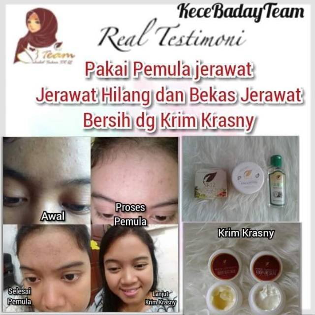 Krasny Cream SR12 | Krasny Day Cream SR12 &amp; Krasny Night Cream SR12 | Krim Wajah SR12 Skincare