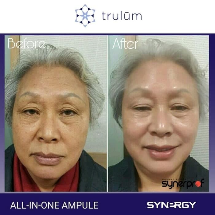 PAKET Serum Krim Cream Pemutih Wajah Terbaik Yang Cepat Ampuh Dan Aman