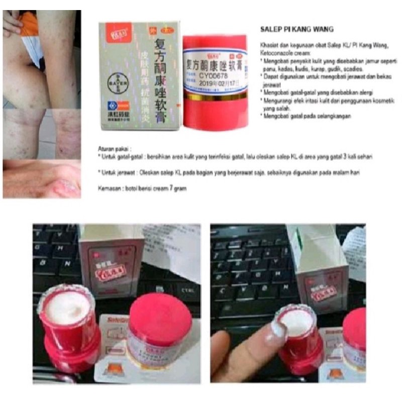 Jual Salep Pi Kang Wang Kl Obat Gatal Eksim Original Shopee Indonesia