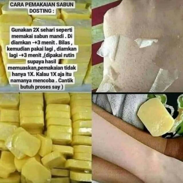 SABUN DOSTING PEMUTIH KULIT ORIGINAL BPOM - DOSTING NATURAL WHITENING SOAP