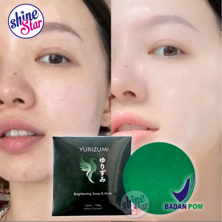 SHINE STAR - TERBARUUU !! Sabun Pemutih Yurizumi Brightening &amp; Acne Soap 100g Original 100% BPOM - Sabun Muka Glowing Penghilang Jerawat dan Flek Hitam Paling Ampuh / Sabun Pembersih Muka Pria Wanita