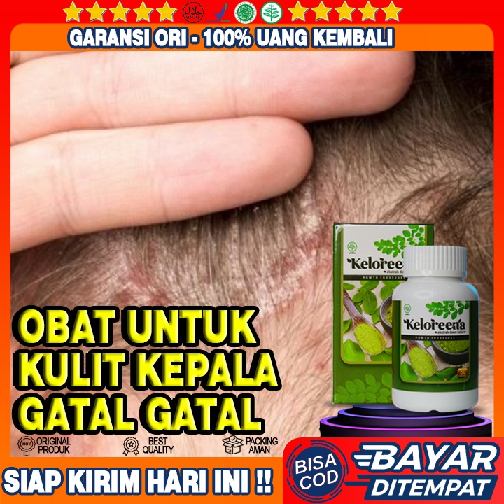 Obat Kulit Kepala Gatal, Obat Ketombe, Obat Kepala Bersisik, Obat Psoriasis, Obat Kemobe Berlebih