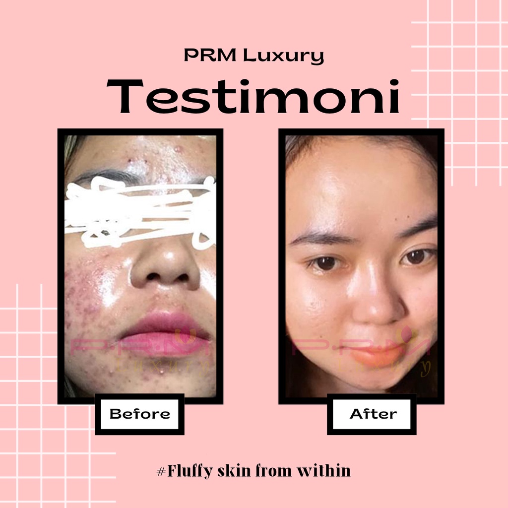 PRM LUXURY BPOM Serum centella level buffet PRM Luxury/ serum acne / bekas jerawat/ whitening/serum wajah/ serum muka