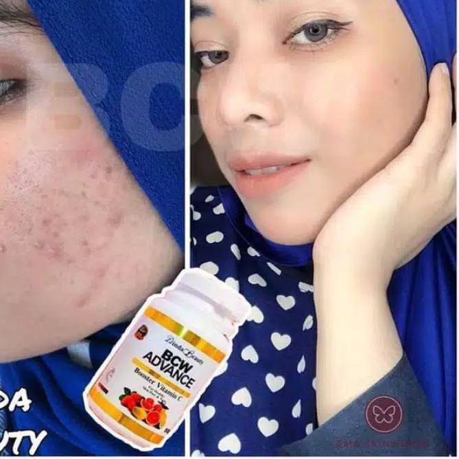 

[VnT⭐ BCW ADVANCE ORIGINAL DINDA BEAUTY / BEAUTY C WHITENING / PEMUTIH KULIT AMAN termurah se indonesia