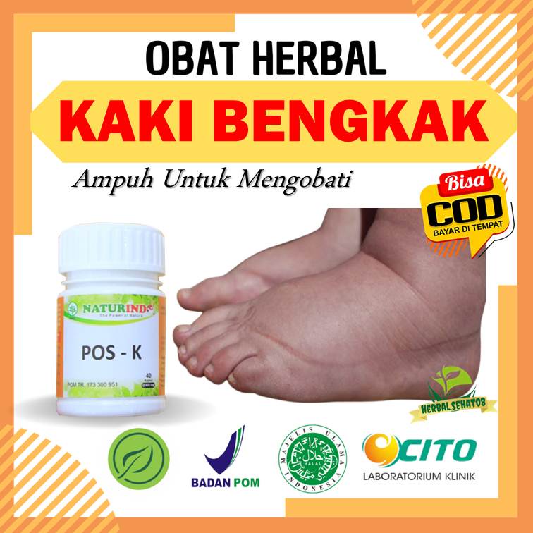 Jual Obat Kaki Bengkak Kaki Gajah Pembengkakan Penyumbatan Tangan Bengkak Benjolan Di Tubuh