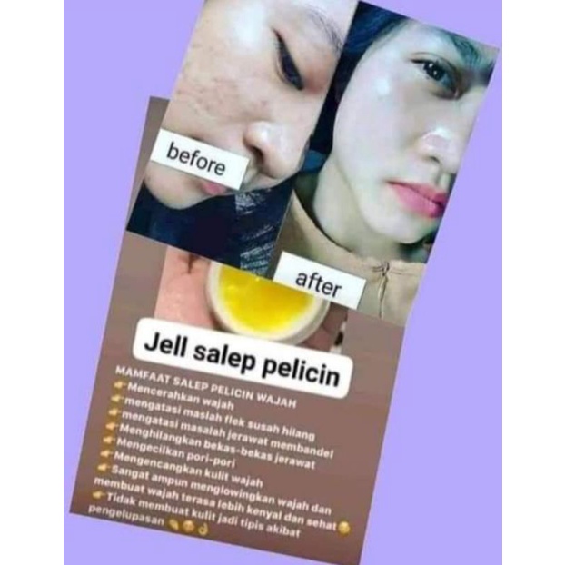 salep pelicin rclinic