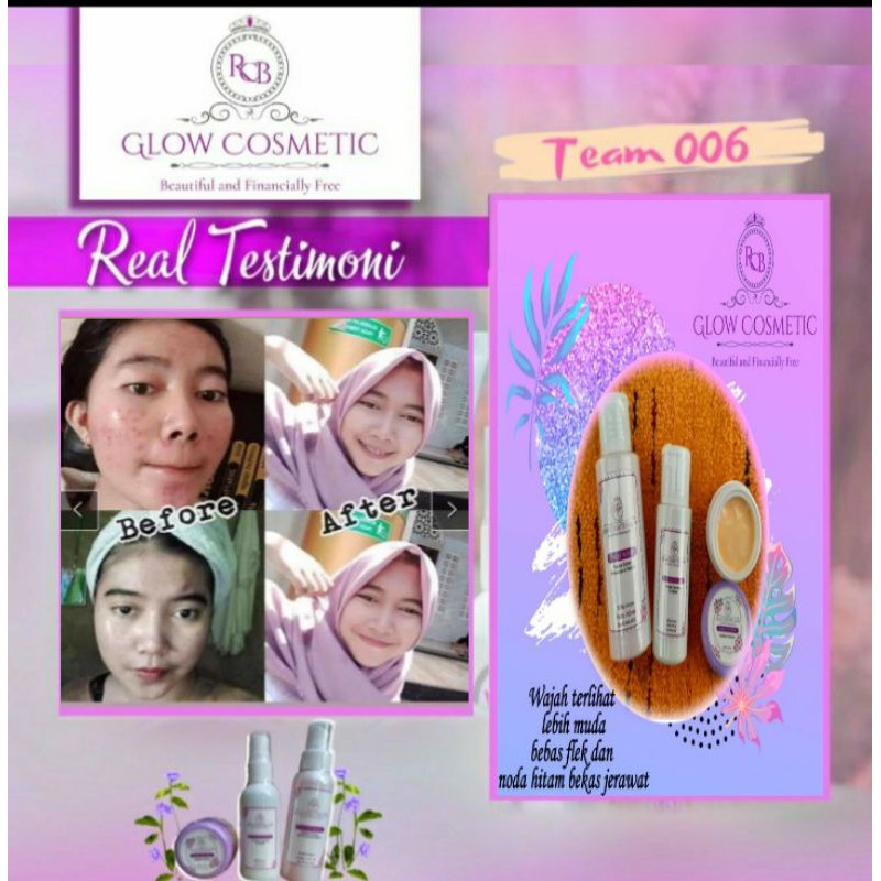 CREAM RCB GLOW ORIGINAL ( KEMASAN BARU) BPOM/WHITENING GLOWING CREAM/CREAM ALL IN 1/ RCB GLOW COSMETIC