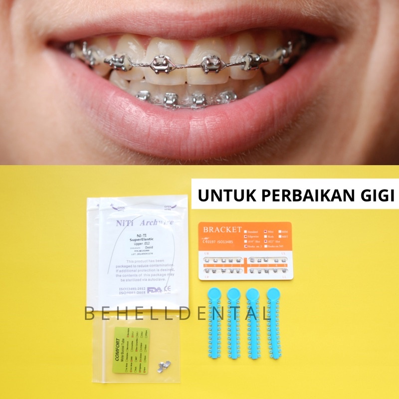 PAKET BEHEL ORIGINAL PERMANEN METAL ORTHO BRACKET FANCY ORENS OREN ORANGE ROTH WITH HOOK - Braces Dental Untuk Perbaikan / Perawatan Gigi - Kawat Orthodontic Metalic Untuk Perawatan Gigi Berantakan - Behelldental