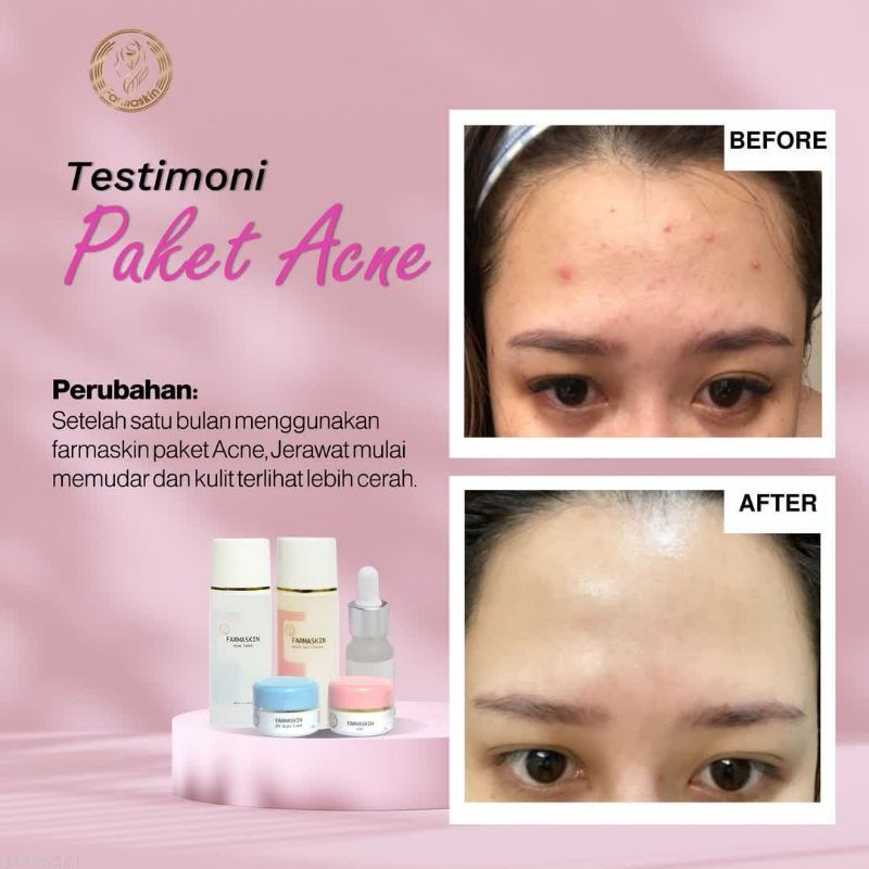 FARMASKIN PAKET ACNE