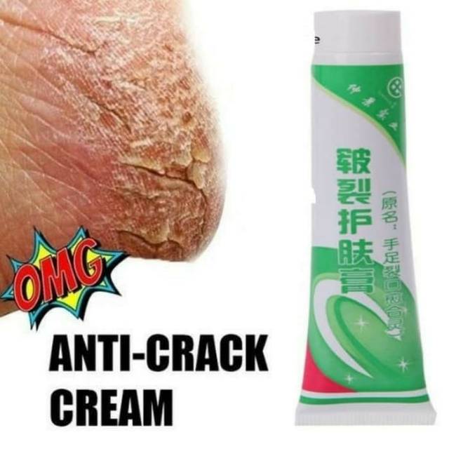 Ready Cream Anti Crack Tumitku