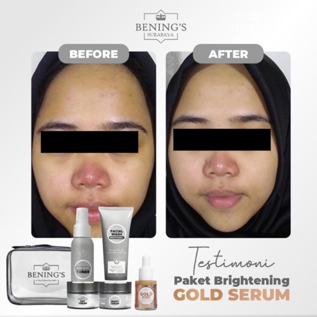 BENING'S PAKET BRIGHTENING | MENCERAHKAN DAN MENGATASI KULIT KUSAM