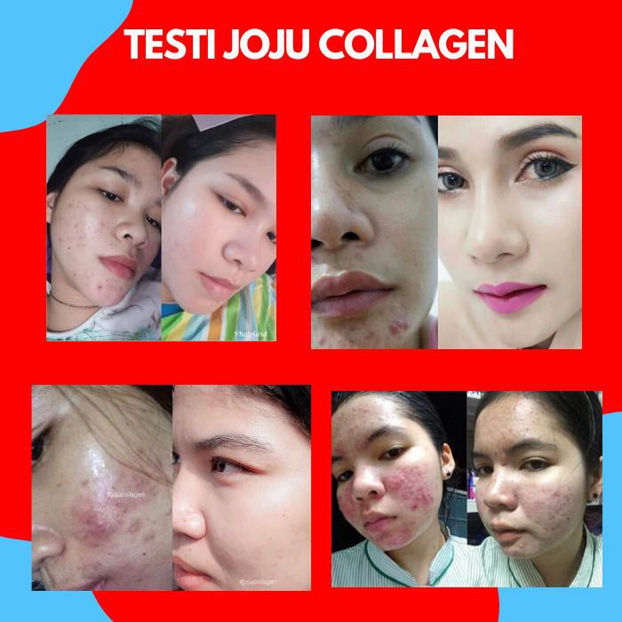 Joju Collagen Colagen Obat Tablet Perawatan Anti Acne Jerawat Pelembab Pemutih Kulit Wajah Badan Cod Indonesia