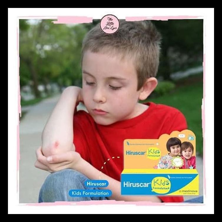 MURAH Hiruscar Kids scar gel penghilang bekas luka anak
