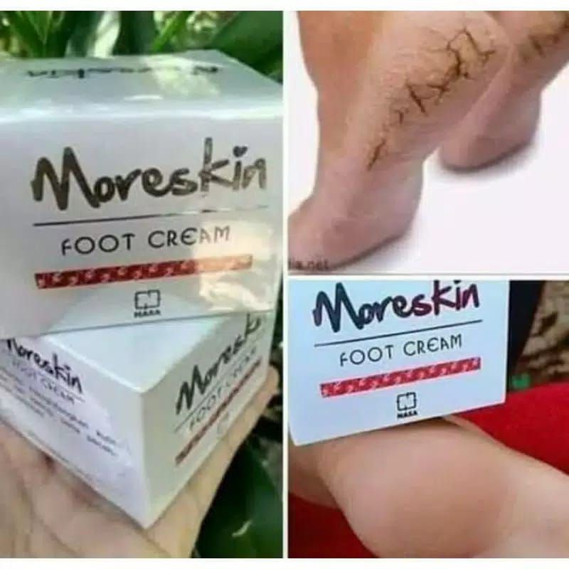 Obat kaki pecah2 - Obat kaki pecah dan kering  - Food Cream Nasa - Cream kaki pecah2 - Kaki pecah2