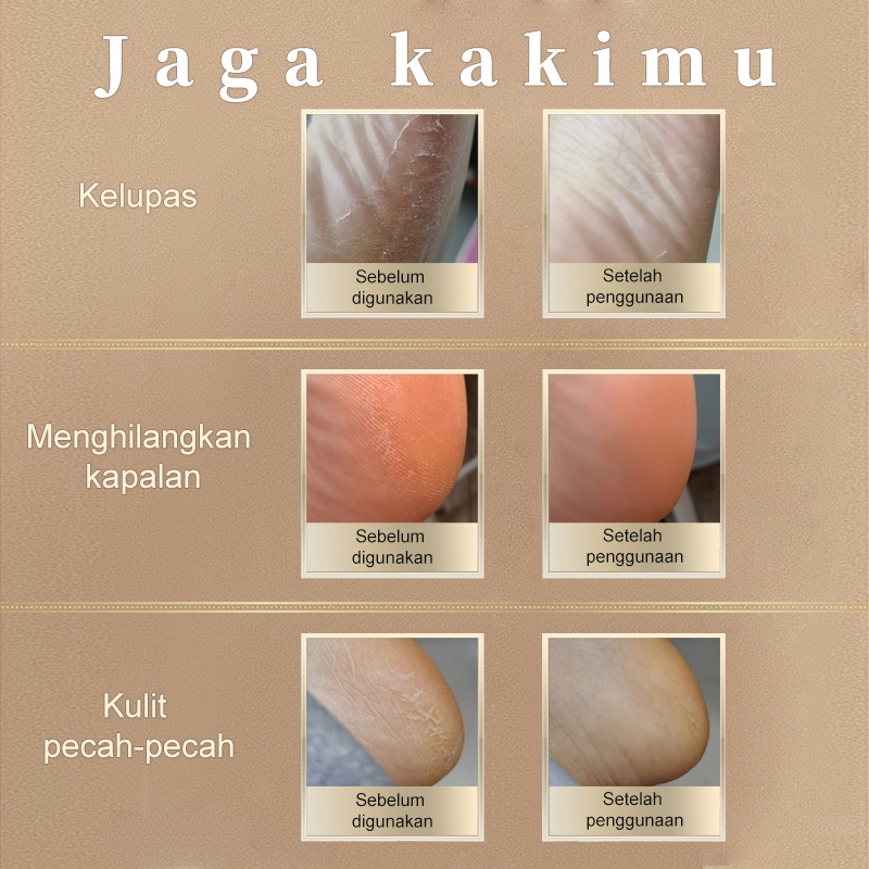 Amazefan Alat Penghalus Kaki Elektrik Pengelupasan pembersih Kulit Untuk Menghilangkan Kulit Mati Kapalan Tumit Alat Amplas Pedicure Menicure Callus Remover Kelupas perawatan kaki Portable Mesin Penghalus Tumit Kaki kikir pengkilap kuku menicure pedicure