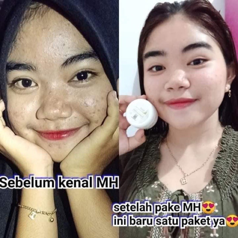 Cream MH Whitening Skin