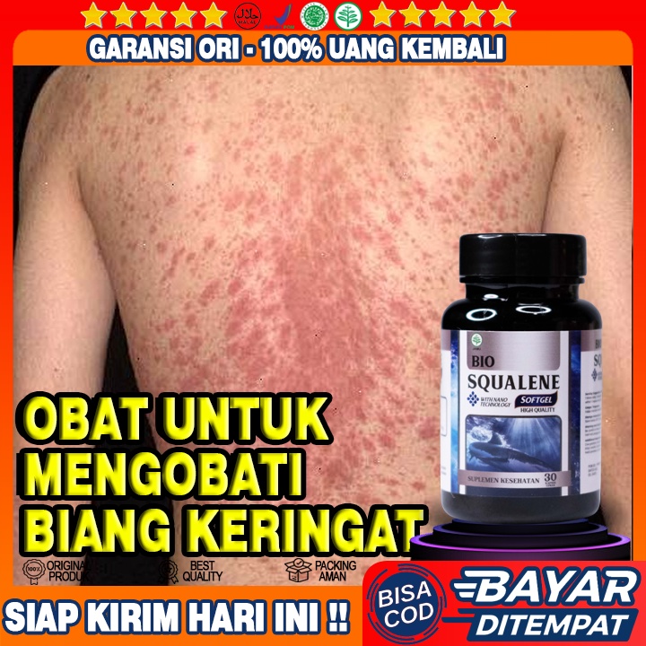 Obat Biang Keringat - Obat Biang Keringat Di Leher - Obat Biang Keringat Gatal Gatal - Obat Gatal Bi