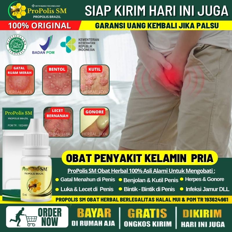Obat Oles Penis Gatal - Gatal, Obat Buah Zakar Gatal, Penghilang Benjolan di Penis, Obat Ruam Merah 