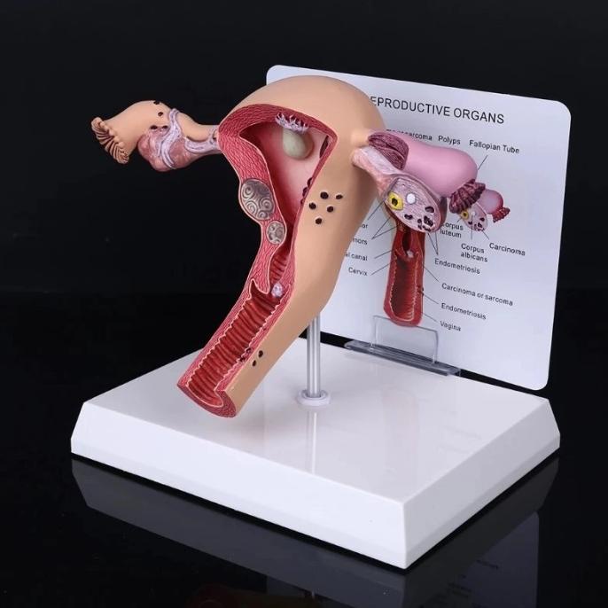 Manekin Alat Peraga Model Anatomi Human Female Uterus Ovary Disease