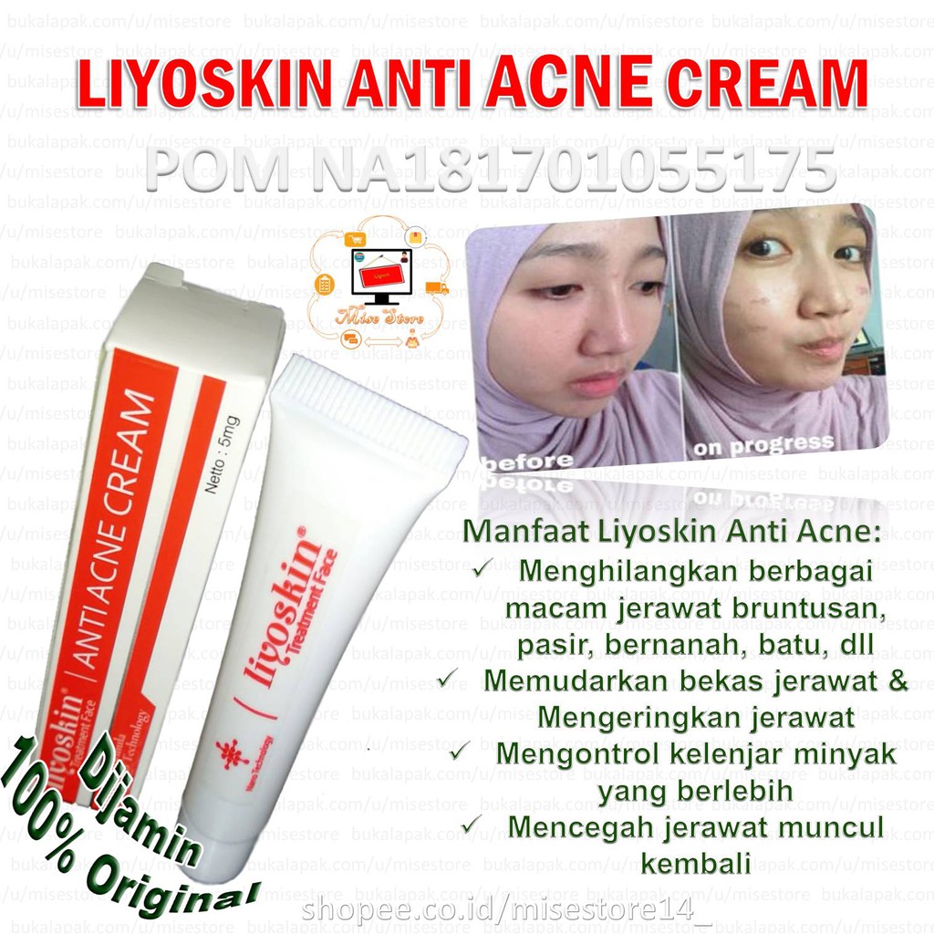 Obat Jerawat Ampuh Liyoskin Anti Acne 100% Original-Obat Jerawat Punggung-Jerawat Pasir