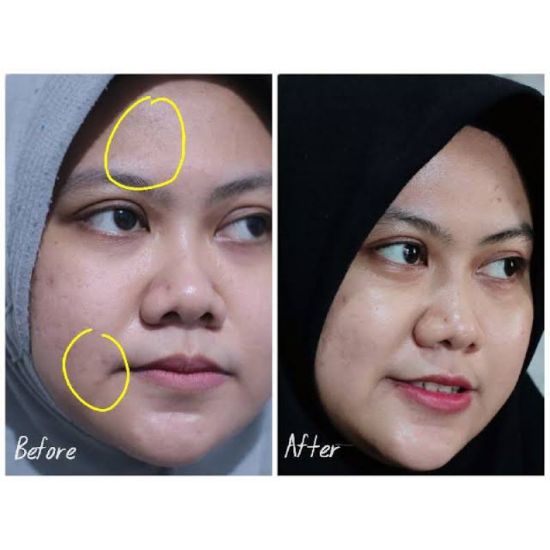 COD - SCARLETT WHITENING CREAM ACNE DAY AND NIGHT - AMPUH BASMI JERAWAT DAN BEKASNYA