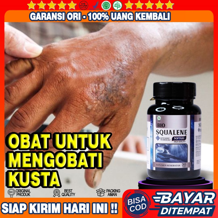 Obat Penyakit Kusta - Obat Kusta Basah & Kering Alami - Obat Penyakit Lepra / Kusta - Pembasmi Bakte