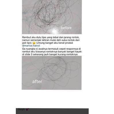 ☼ RONTOK BOTAK Manise Hair Oil - CEK TESTI tonic serum minyak rambut kemiri follow me shampoo fall ♟