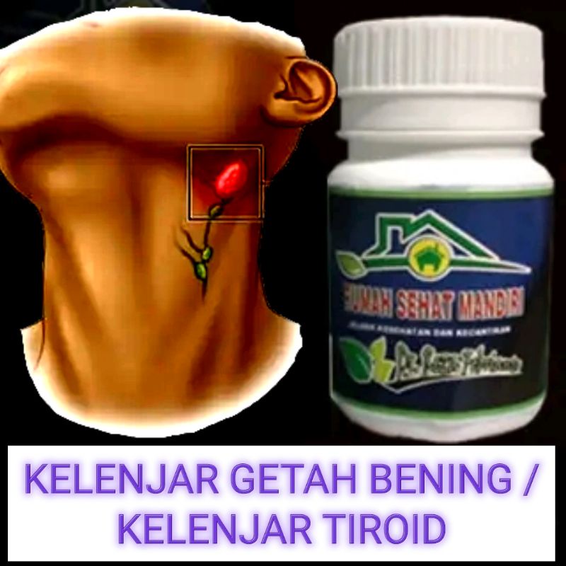 Obat Kelenjar getah bening - Tiroid - KGB - LIMFOMA